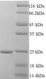 Human HN1 protein
