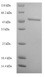 Human ACAA1 protein