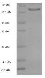 Human ARSG protein