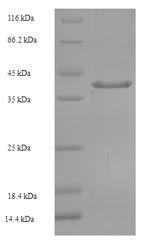 Human GOSR2 protein