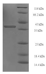 Human PSMD10 protein