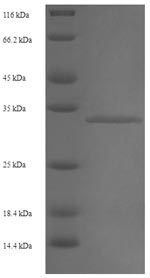 Human RBM3 protein