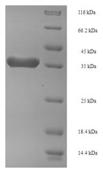 E.coli SPT16 protein