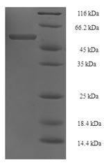 E.coli tuf1 protein