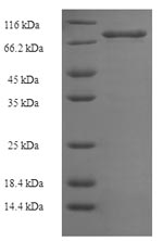 Human XIAP protein