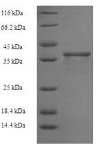 Human ZNF26 protein