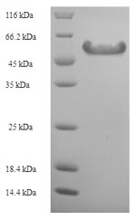 E.coli Pectate lyase 5 protein