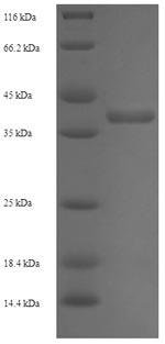 E.coli hup1 protein