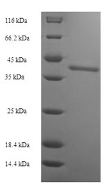 Human SSX2 protein