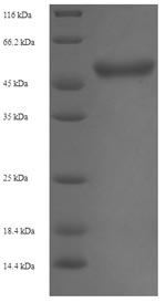 E.coli fabD protein