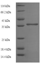 Human C11orf73 protein