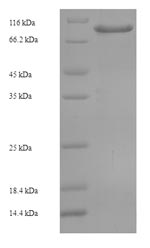 Human CCDC36 protein