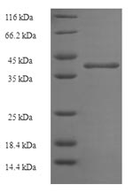 Human N6AMT2 protein