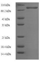 Human PIK3R5 protein
