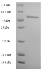 Human RDH12 protein