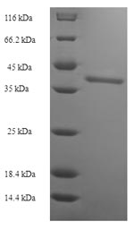 Human BTN2A2 protein