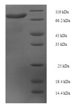 Human KLHL36 protein