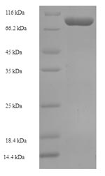 Human EME1 protein