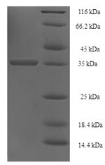 E.coli C12orf49 protein