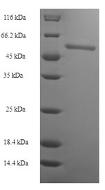 Human GMPR2 protein