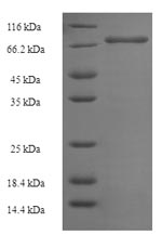 Human NLE1 protein