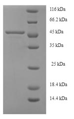 Human AGXT protein
