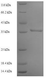 Human AK1 protein