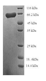 Human ALDH5A1 protein