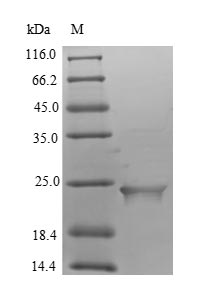 Human ASAH2B protein