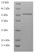 Human CAPZA2 protein