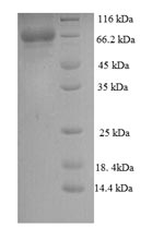 Human CAST protein