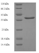 Human P52943 protein