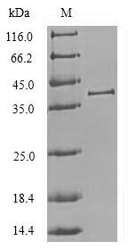 E.coli CTSL protein