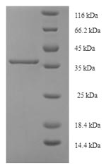 Human CYGB protein