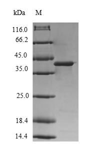 Human DGKG protein