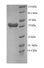 Human DTWD1 protein