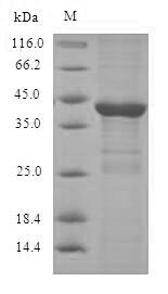 Human DUSP14 protein