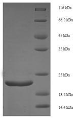 Mouse Fgf21 protein