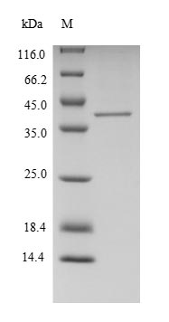 Human FTSJ1 protein