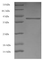 Human GABRA4 protein