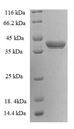 Human GAGE5 protein