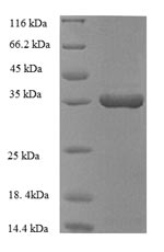 Human HMOX1 protein