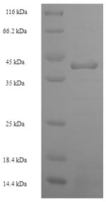 Human HNRNPL protein