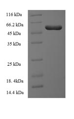 Human ILKAP protein