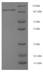 Mouse Irf5 protein