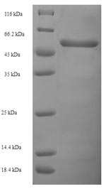 Human KCNAB2 protein