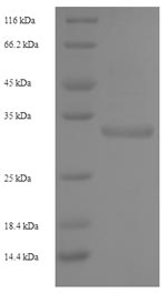 Human KLRC2 protein