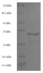 Human LSM4 protein