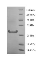 Human LYZ protein