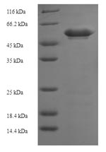 Human MAP2K3 protein